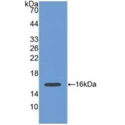 Periostin (POSTN) Antibody