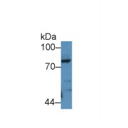 Western blot analysis of Rat Lung lysate, using Rat POSTN Antibody (2 µg/ml) and HRP-conjugated Goat Anti-Rabbit antibody (<a href="https://www.abbexa.com/index.php?route=product/search&amp;search=abx400043" target="_blank">abx400043</a>, 0.2 µg/ml).