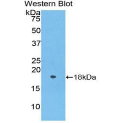 Periostin (POSTN) Antibody