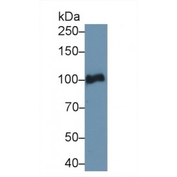 Plasminogen (PLG) Antibody