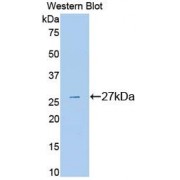 Western blot analysis of recombinant Mouse PLG Protein.