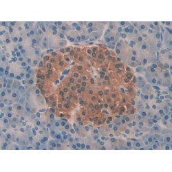 Profilin 2 (PFN2) Antibody