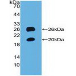 Spondin 1 (SPON1) Antibody