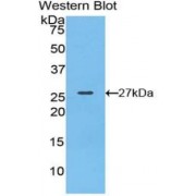 Western blot analysis of the recombinant protein.