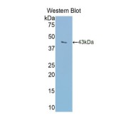 Western blot analysis of the recombinant protein.