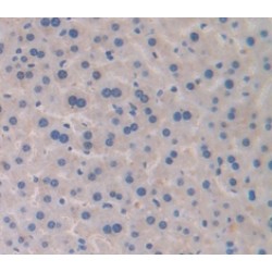 Transferrin (TF) Antibody