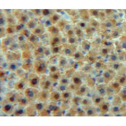 Transferrin (TF) Antibody