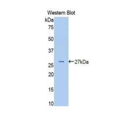 Transferrin (TF) Antibody