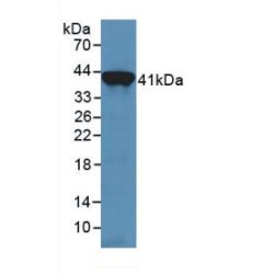 Transferrin (TF) Antibody