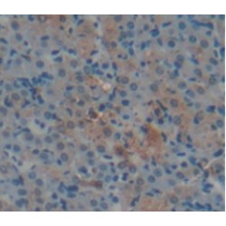 Aconitase 1 (ACO1) Antibody