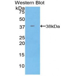 Annexin A5 (ANXA5) Antibody
