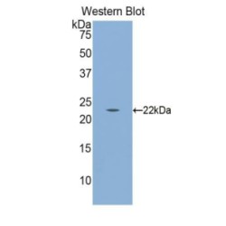 Calreticulin (CALR) Antibody