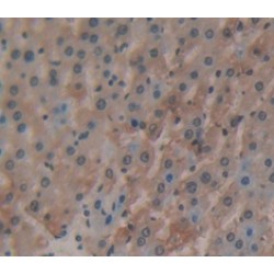 Cathepsin A (CTSA) Antibody