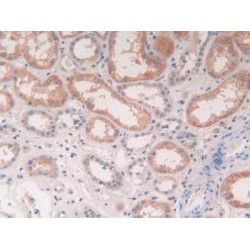 Cathepsin S (CTSS) Antibody