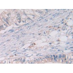 Cathepsin S (CTSS) Antibody