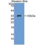 Western blot analysis of recombinant Mouse CTSS.