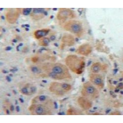 Cathepsin S (CTSS) Antibody