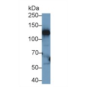 Western blot analysis of Human Liver lysate, using Human CP Antibody (1 µg/ml) and HRP-conjugated Goat Anti-Rabbit antibody (<a href="https://www.abbexa.com/index.php?route=product/search&amp;search=abx400043" target="_blank">abx400043</a>, 0.2 µg/ml).