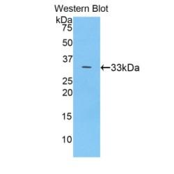 Ceruloplasmin (CP) Antibody