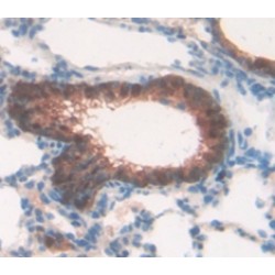 Gap Junction Beta-3 Protein / CX31 (GJB3) Antibody