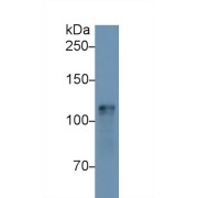 Western blot analysis of Mouse Heart lysate, using Mouse HK1 Antibody (1 µg/ml) and HRP-conjugated Goat Anti-Rabbit antibody (<a href="https://www.abbexa.com/index.php?route=product/search&amp;search=abx400043" target="_blank">abx400043</a>, 0.2 µg/ml).