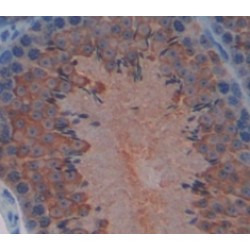 Hexokinase 1 (HK1) Antibody