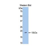 Western blot analysis of the recombinant protein.