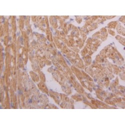 Hexokinase 1 (HK1) Antibody