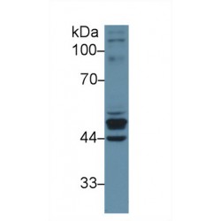 Keratin 23 (KRT23) Antibody