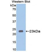 Western blot analysis of recombinant Human KRT23 Protein.