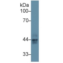 Keratin 23 (KRT23) Antibody