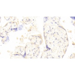 Keratin 23 (KRT23) Antibody