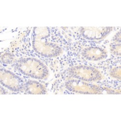 Keratin 23 (KRT23) Antibody