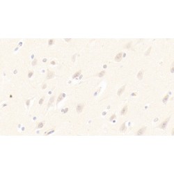 Keratin 23 (KRT23) Antibody