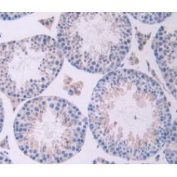 Oncostatin M (OSM) Antibody