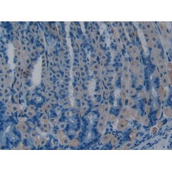 Somatostatin (SST) Antibody