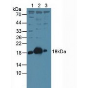 Western blot analysis of (1) Human HeLa cells, (2) Rat Brain Tissue and (3) Mouse Brain Tissue.