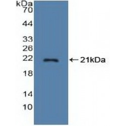 Stathmin 1 (STMN1) Antibody