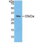 Western blot analysis of recombinant Human TF.