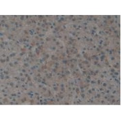 Tissue Factor (TF) Antibody