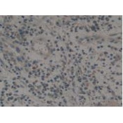 Tissue Factor (TF) Antibody