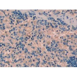 Urocortin 1 (UCN1) Antibody