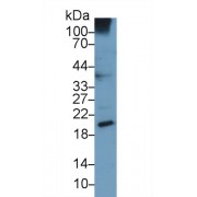 Western blot analysis of Human A549 cell lysate, using Human UCN3 Antibody (3 µg/ml) and HRP-conjugated Goat Anti-Mouse antibody (<a href="https://www.abbexa.com/index.php?route=product/search&amp;search=abx400001" target="_blank">abx400001</a>, 0.2 µg/ml).