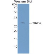 Western blot analysis of the recombinant protein.