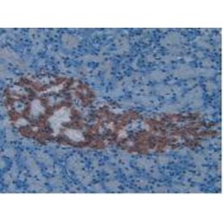 Endothelin 1 (EDN1) Antibody