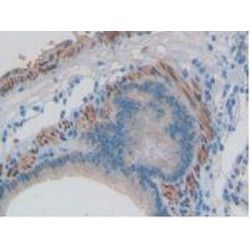 Endothelin 1 (EDN1) Antibody