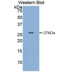 Gastrokine 2 (GKN2) Antibody