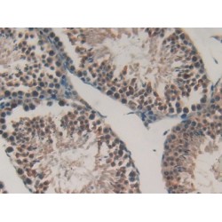 Gastrokine 2 (GKN2) Antibody