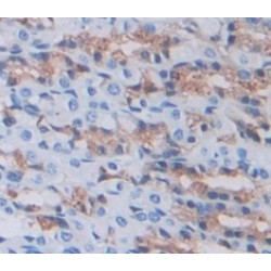 Gastrokine 2 (GKN2) Antibody