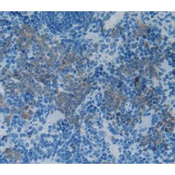 Interleukin 2 (IL2) Antibody